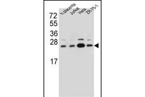 SSR2 Antibody (C-term) (ABIN657094 and ABIN2846252) western blot analysis in human placenta tissue and Jurkat,Hela,ZR-75-1 cell line lysates (35 μg/lane). (SSR2 antibody  (C-Term))