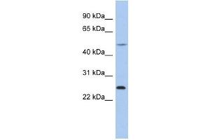 Chymotrypsinogen B1 antibody used at 1 ug/ml to detect target protein.