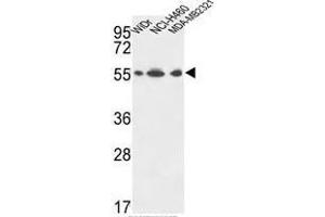 ATP5A1 Antibody (C-term) western blot analysis in WiDr,NCI-H460,MDA-MB231 cell line lysates (35µg/lane). (MT-ATP6 antibody  (C-Term, Subunit alpha))