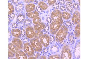 Paraformaldehyde-fixed, paraffin embedded human kidney, Antigen retrieval by boiling in sodium citrate buffer (pH6) for 15min, Block endogenous peroxidase by 3% hydrogen peroxide for 30 minutes, Blocking buffer at 37°C for 20min, Antibody incubation with TrkB (Tyr817) (2A1 ) Monoclonal Antibody  at 1:50 overnight at 4°C, followed by a conjugated secondary and DAB staining. (TRKB antibody  (pTyr817))