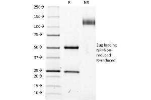 SDS-PAGE Analysis Purified CD25 Mouse Monoclonal Antibody (IL2RA/423). (CD25 antibody)