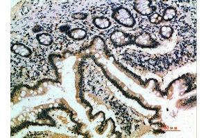 Immunohistochemical analysis of paraffin-embedded human-small-intestine, antibody was diluted at 1:200 (IL17B antibody  (AA 1-50))