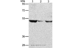 Western blot analysis of PC3 cell and mouse muscle tissue, A375 cell, using MMP1 Polyclonal Antibody at dilution of 1:500 (MMP1 antibody)