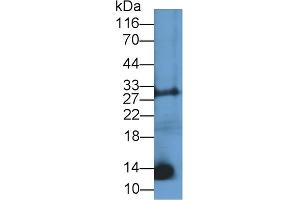 Detection of CNP in Mouse Liver lysate using Polyclonal Antibody to C-Type Natriuretic Peptide (CNP) (NPPC antibody  (AA 33-125))