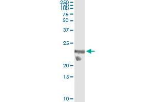 TSC22D3 (Human) IP-WB Antibody Pair