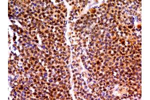 Image no. 1 for anti-MutL Homolog 1 (MLH1) (AA 289-492) antibody (ABIN5027360) (MLH1 antibody  (AA 289-492))