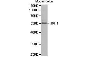 Western Blotting (WB) image for anti-Histamine Receptor H1 (HRH1) antibody (ABIN1873083) (HRH1 antibody)