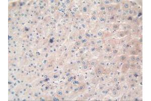 Figure. (TTR antibody  (AA 21-147))