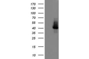 HEK293T cells were transfected with the pCMV6-ENTRY control (Left lane) or pCMV6-ENTRY ELK3 (Right lane) cDNA for 48 hrs and lysed. (ELK3 antibody)