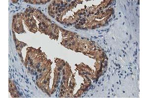 Image no. 1 for anti-Acetyl-CoA Acetyltransferase 2 (ACAT2) antibody (ABIN1496396) (ACAT2 antibody)