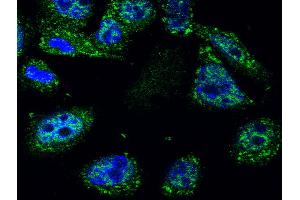 Image kindly submitted by Piotr Mamczur from Wroclaw University. (p53 antibody  (AA 251-310))