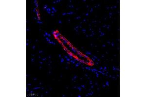 Immunofluorescence analysis of paraffin embedded rat skeletal muscle using ACTN1 (ABIN7072905) at dilution of 1: 500 (ACTN1 antibody)