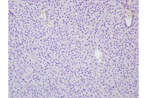 Paraformaldehyde-fixed, paraffin embedded Mouse liver; Antigen retrieval by boiling in sodium citrate buffer (pH6. (RNF213 antibody  (AA 4750-4800))