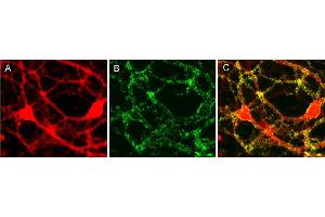 Immunocytochemistry (ICC) image for anti-Liprin alpha 3 (PPFIA3) (AA 463-604) antibody (ABIN1742356) (LIPA3 antibody  (AA 463-604))