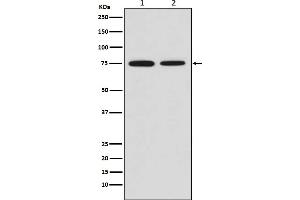 Western blot analysis of MSR1 expression in (1) HeLa cell lysate, (2) Mouse placenta lysate.