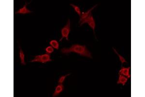 ABIN6274406 staining 293 by IF/ICC. (ARMCX2 antibody  (Internal Region))