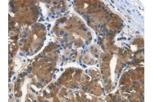 Detection of Cys-C in Human Stomach Tissue using Monoclonal Antibody to Cystatin C (Cys-C) (Cystathionine-gamma-Synthase Precursor (CYS) (AA 27-146) antibody)