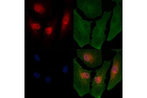 ABIN6264196 and ABIN6266654 staining  cells by IF/ICC. (PIAS2 antibody  (N-Term))