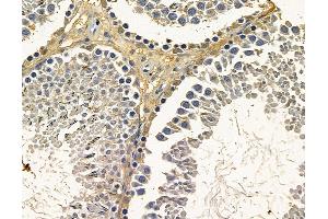 ABIN7096796 and ABIN7100862 at 1/100 staining rat testis tissue by IHC-P.