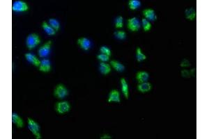 Immunofluorescence staining of Hela cells with ABIN7159477 at 1:50, counter-stained with DAPI. (TRABD2B antibody  (AA 195-405))