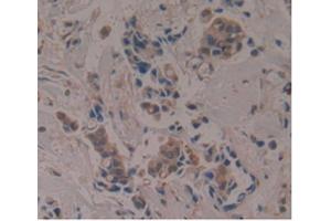 Figure. (APOA1BP antibody  (AA 118-282))