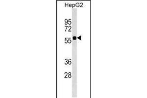 Western blot analysis in HepG2 cell line lysates (35ug/lane). (SRCRB4D antibody  (AA 165-191))