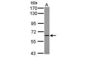 Image no. 2 for anti-Myotubularin Related Protein 9 (MTMR9) (AA 254-428) antibody (ABIN1499593) (MTMR9 antibody  (AA 254-428))