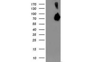 Western Blotting (WB) image for anti-Asparagine Synthetase (ASNS) antibody (ABIN1496750) (Asparagine Synthetase antibody)