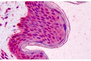Human Skin: Formalin-Fixed, Paraffin-Embedded (FFPE) (RAD51 antibody)