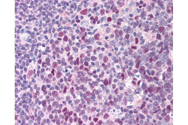ERCC3 antibody  (C-Term)