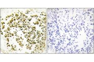 Immunohistochemistry analysis of paraffin-embedded human lymph node tissue, using Musculin Antibody. (Musculin antibody  (AA 131-180))