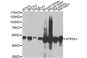 Western blot analysis of extracts of various cell lines, using ATP5A1 Antibody (ABIN5973488) at 1/1000 dilution. (ATP5A1 antibody)