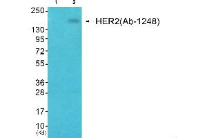 Western blot analysis of extracts from HepG2 cells, using HER2 (phospho-Tyr1248) antibody. (ErbB2/Her2 antibody  (pTyr1248))