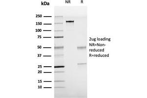 SDS-PAGE Analysis Purified TTF-1 Mouse Recombinant Monoclonal Antibody (rNX2. (Recombinant NKX2-1 antibody)