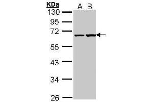 WB Image Sample (30 ug of whole cell lysate) A: A431 , B: H1299 10% SDS PAGE antibody diluted at 1:1000 (PHF1 antibody)
