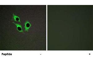 Immunofluorescence analysis of HepG2 cells, using ANO9 polyclonal antibody . (ANO9 antibody)