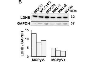 LDHB is inversely correlated with miR-375 in MCC tumors and cell lines. (LDHB antibody  (AA 1-334))