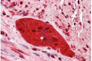 Human Small Intestine, Myenteric Plexus: Formalin-Fixed, Paraffin-Embedded (FFPE) (ZEB2 antibody  (C-Term))
