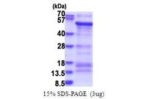 SDS-PAGE (SDS) image for SAM Domain, SH3 Domain and Nuclear Localization Signals, 1 (SAMSN1) (AA 1-373) protein (His tag) (ABIN5853762)