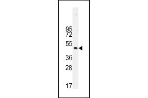 Western blot analysis of anti-Desmin Antibody (t16) (ABIN389226 and ABIN2839379) in NCI- cell line lysates (35 μg/lane). (Desmin antibody  (AA 1-30))