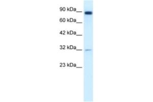 Western Blotting (WB) image for anti-Matrix Metallopeptidase 9 (Gelatinase B, 92kDa Gelatinase, 92kDa Type IV Collagenase) (MMP9) antibody (ABIN2460650) (MMP 9 antibody)