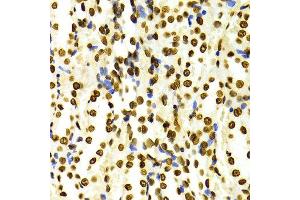 Immunohistochemistry of paraffin-embedded Rat kidney using H3K27me2 antibody at dilution of 1:100 (x400 lens). (Histone 3 antibody  (H3K27me))