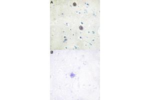 Immunohistochemical staining of human brain tissue by APP (phospho T743/668) polyclonal antibody  without blocking peptide (A) or preincubated with blocking peptide (B) under 1:50-1:100 dilution. (APP antibody  (pThr668, pThr743))