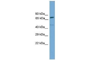 WB Suggested Anti-Trp73 Antibody Titration:  0. (Tumor Protein p73 antibody  (N-Term))