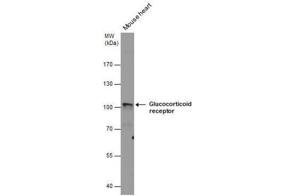 Glucocorticoid Receptor antibody  (N-Term)