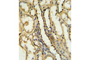 TR Antibody (N-term) 6545a IHC analysis in formalin fixed and paraffin embedded human kidney tissue followed by peroxidase conjugation of the secondary antibody and DAB staining. (CD40 Ligand antibody  (N-Term))