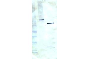 Western blot using anti-PARP1, clone C-2-10. (PARP1 antibody)