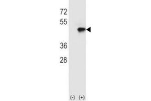 Western blot analysis of CD4 antibody and 293 cell lysate (2 ug/lane) either nontransfected (Lane 1) or transiently transfected with the CD4 gene (2). (CD4 antibody  (AA 58-86))