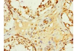 Immunohistochemistry of paraffin-embedded human testis tissue using ABIN7154932 at dilution of 1:100 (HHIP antibody  (AA 18-220))