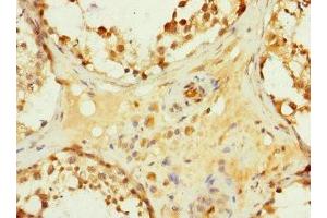Immunohistochemistry of paraffin-embedded human testis tissue using ABIN7154932 at dilution of 1:100